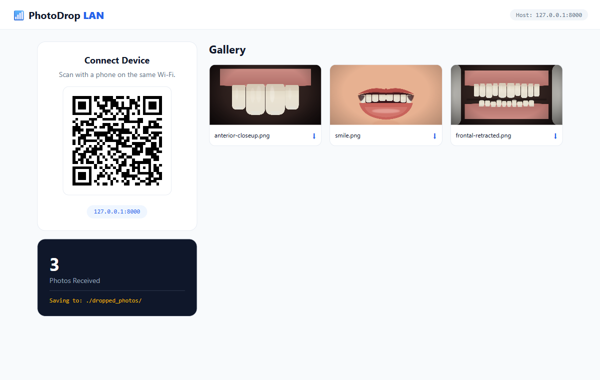The PhotoDrop desktop dashboard: a Connect Device card with a locally-generated QR code, a photos-received counter with the save path, and a gallery showing intraoral and extraoral clinical photos that just arrived from a phone.