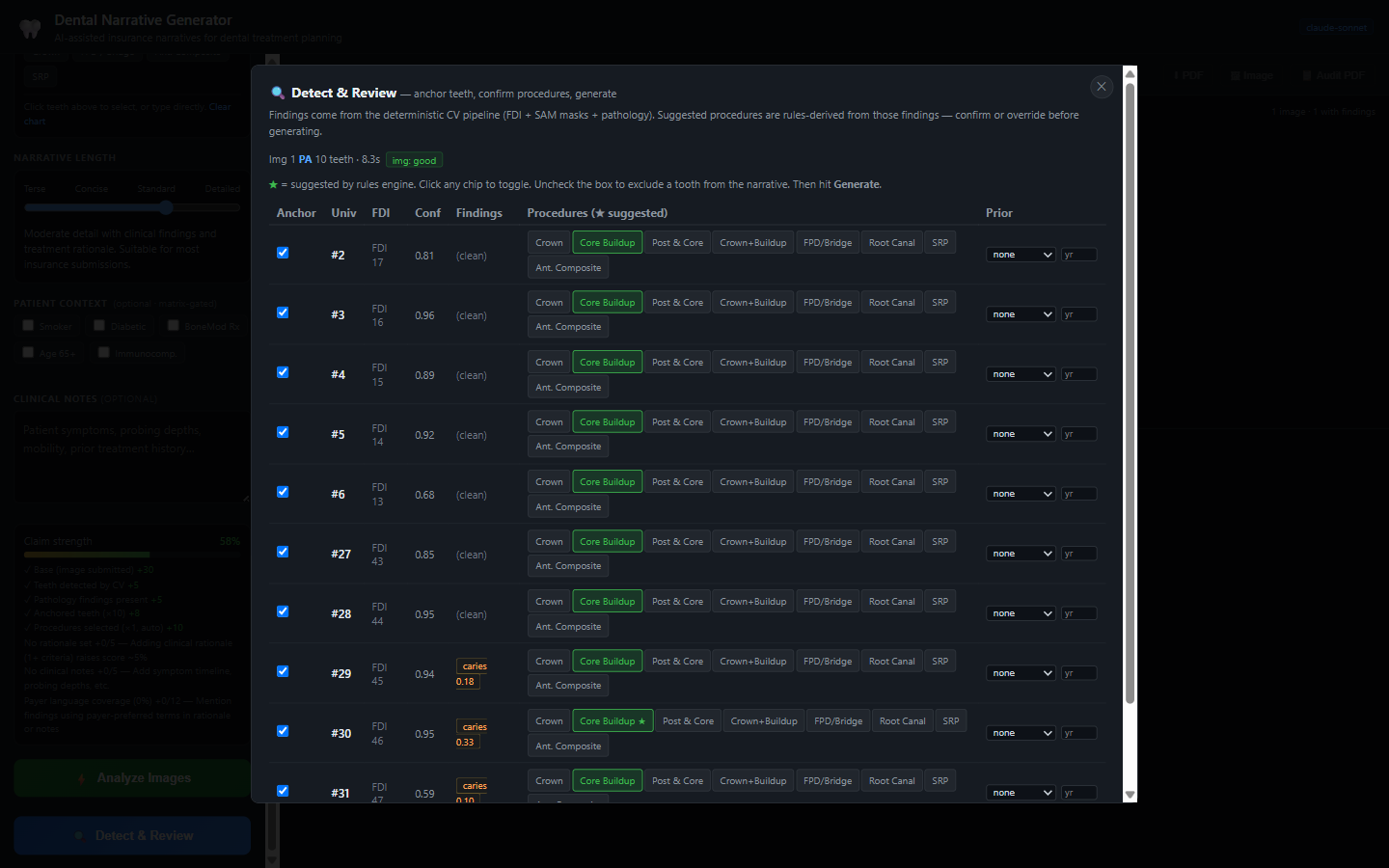 The Detect and Review modal: a per-tooth table listing anchor checkboxes, Universal and FDI numbers, detection confidence, findings such as caries with a score, and rules-suggested procedure chips (Core Buildup starred) plus a prior-restoration dropdown for each tooth.
